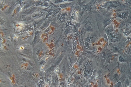 Adipocytes